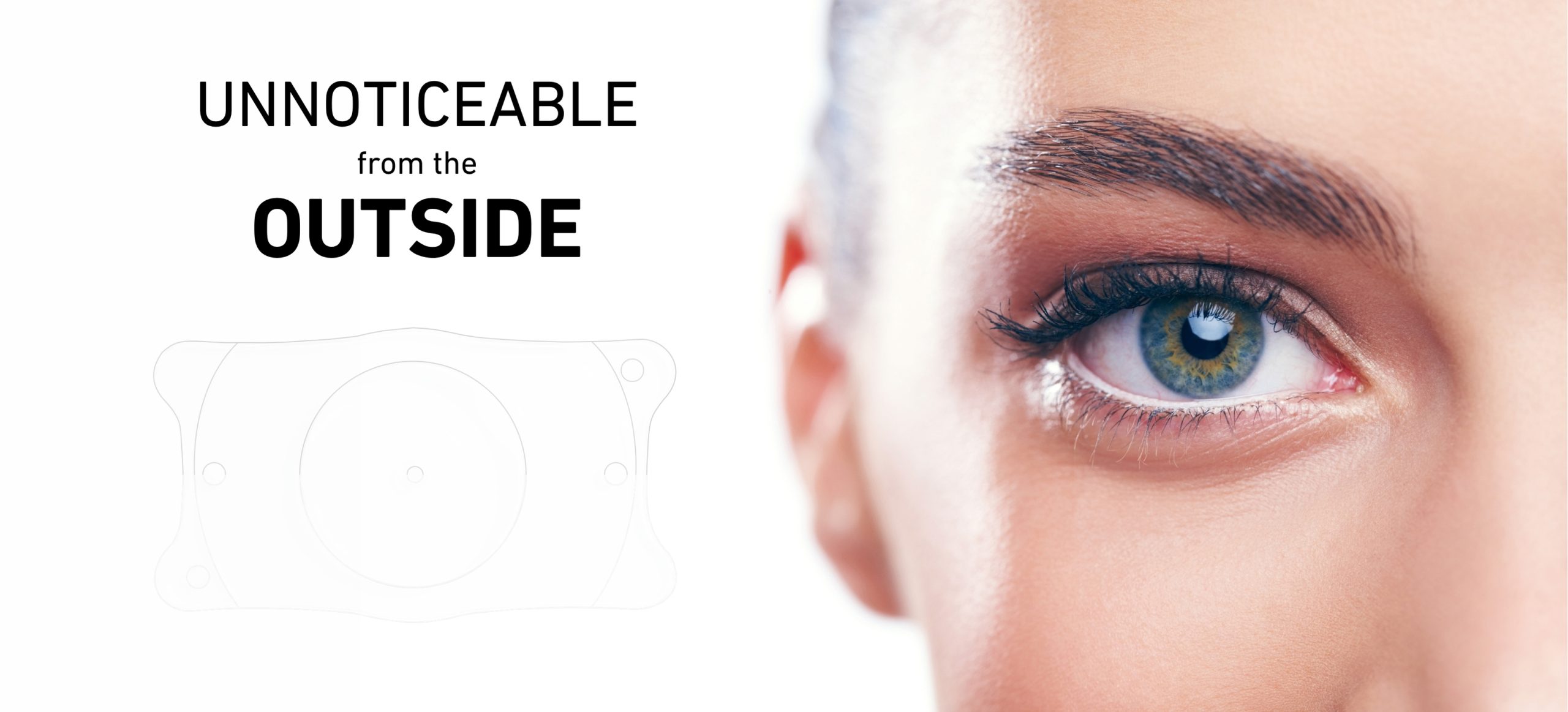 The Aesthetic Advantages of Phakic Lenses Unnoticeable from the Outside